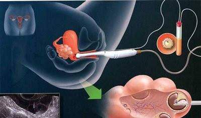 胚胎实验室